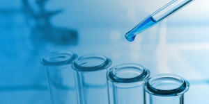 Laboratory test tubes and pipette
